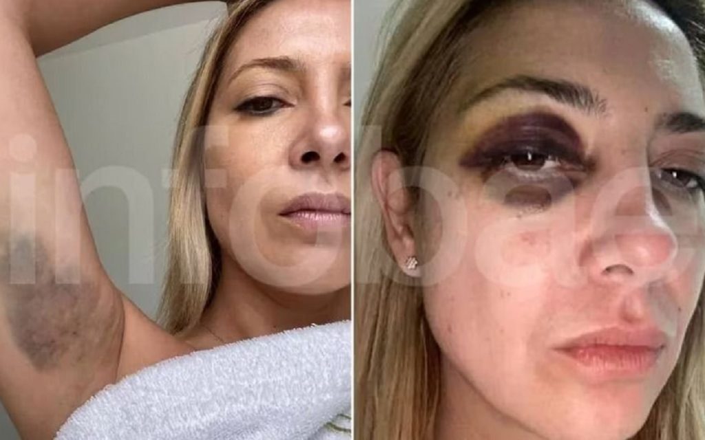Revelan las fotos de Fabiola Yáñez agredida por Alberto Fernández