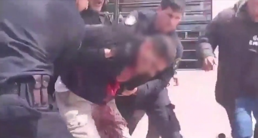Termas: cómo se encuentra la mujer apuñalada y qué pasará con el agresor tras su intento de suicidio