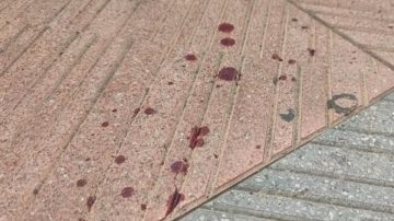 Sangrienta pelea en Añatuya: tres personas resultaron apuñaladas