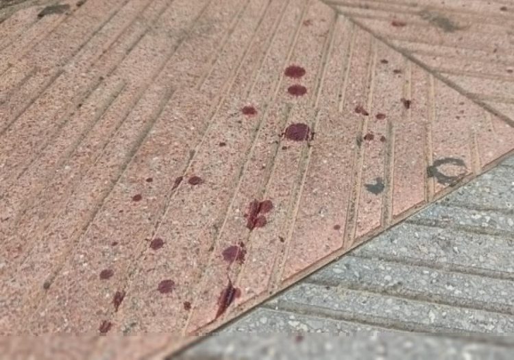 herido de arma blanca