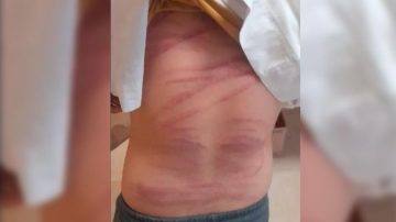 Brutal agresión en Sumampa: quedó detenida por azotar a su hijo de 10 años con un cable