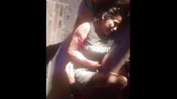 Giro de 180° en el caso de la mujer mordida por dos perros en La Banda