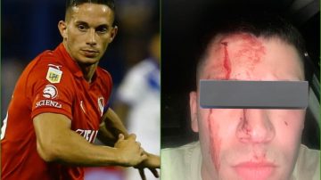 Así quedó el socio que denunció a Iván Marcone por la agresión