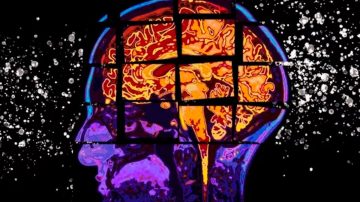 Cuáles son los tres factores que aumentan el riesgo de ACV con secuelas graves