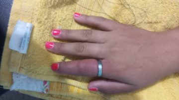 FOTOS. Bomberos auxiliaron a una menor que tenía un anillo atascado en su dedo