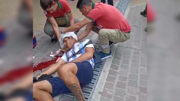 Pelea entre vendedores ambulantes dejó a uno con una profunda herida en la cabeza y al otro, preso