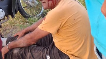 Dos hombres resultaron heridos tras derrapar en una motocicleta en Ruta 1