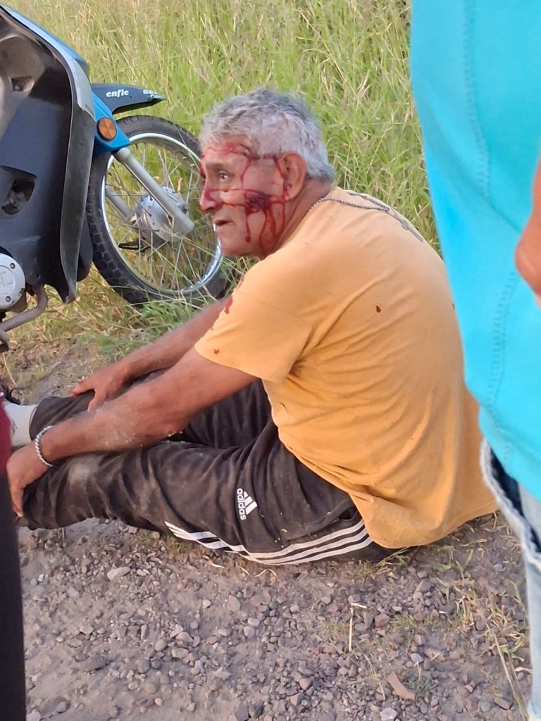 Dos hombres resultaron heridos tras derrapar en una motocicleta en Ruta 1