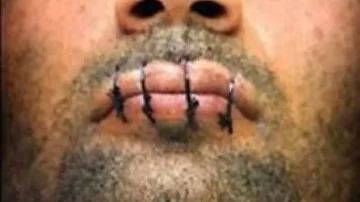 Joven preso se cosió la boca con alambre exigiendo que lo trasladen de comisaría