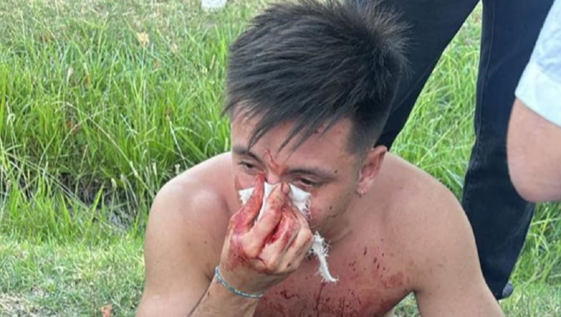 Rugbiers atacaron en patota a un joven durante los festejos de Navidad