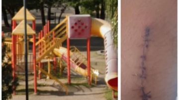 Una niña sufrió un corte en una de sus piernas cuando jugaba en el Parque de los Niños