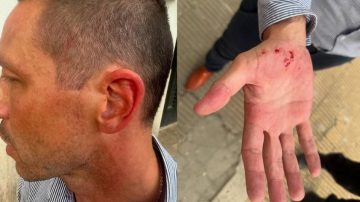 Video: un traumatólogo denunció más de 20 veces a su ex y la detuvieron recién cuando agredió a un policía