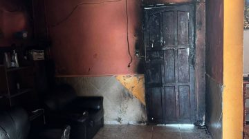 Un hombre de 69 años en estado crítico tras explotarle una botella de alcohol