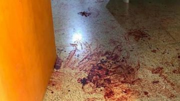 Terrible pelea entre dos hombres que compartían bebidas: uno fue atacado con un hierro y se defendió con una tijera