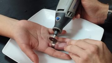 Se le atoró un anillo en el dedo y tuvo que acudir a los bomberos