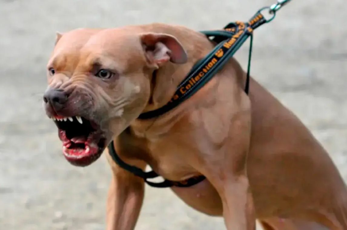 Un Pitbull mordió en la cara a una nena de 5 años y “agarró” del pañal a su hermanito de 9 meses