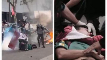 Un reportero fue gravemente herido mientras trabajaba en la marcha al Congreso