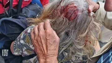La policía derribó de un golpe a una jubilada en medio de la brutal represión
