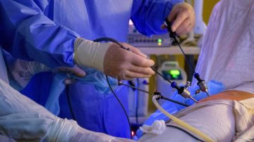 Realizarán un operativo de ligadura de trompas por vía laparascópica gratis en el Hospital de Loreto