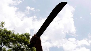 Pelea de hermanos en La Banda terminó con uno herido de un machetazo en la cabeza