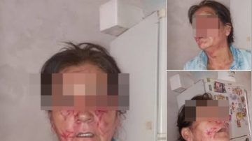 “Esto ya no es vida”: grave denuncia de una mujer contra vecinas que agredieron a su suegra