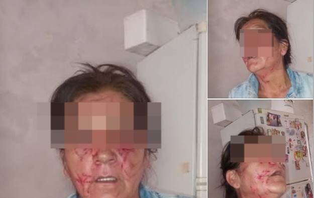 “Esto ya no es vida”: grave denuncia de una mujer contra vecinas que agredieron a su suegra