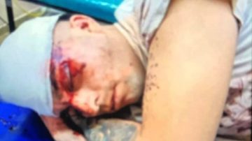 Denuncian que un joven recibió una feroz golpiza que lo dejó al borde de la muerte