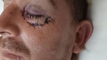 Profesor de kickboxing desfiguró y dejó con lesiones gravísimas a un futbolista amateur