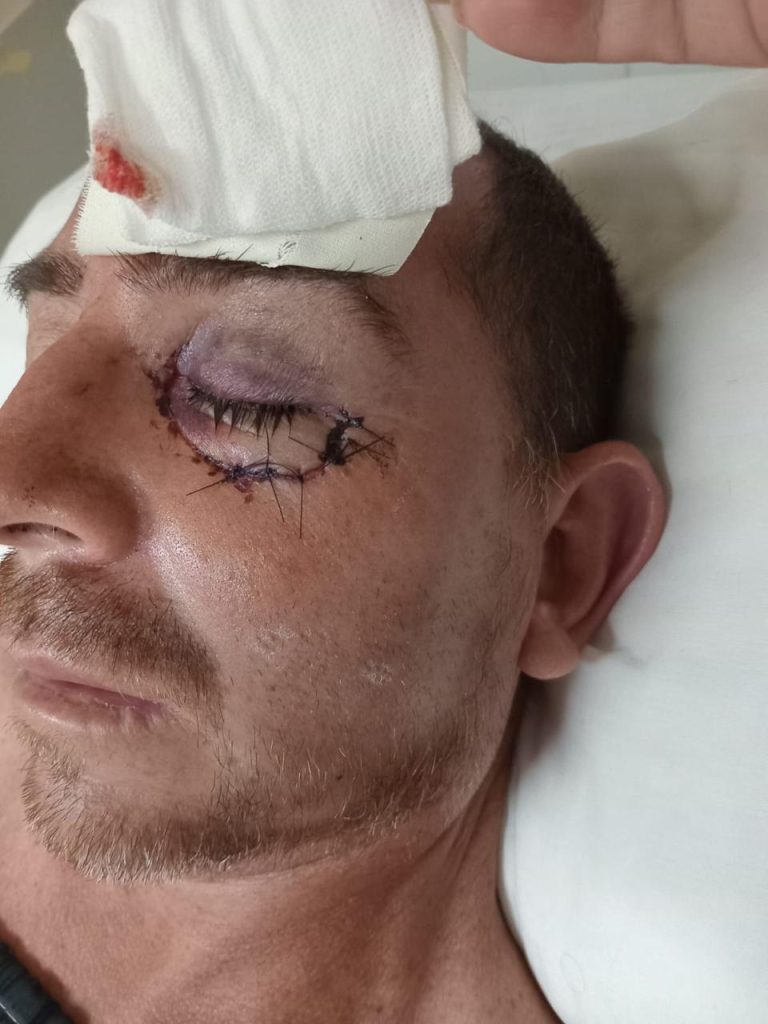 Profesor de kickboxing desfiguró y dejó con lesiones gravísimas a un futbolista amateur