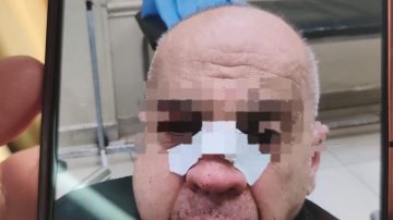 “Desfiguró a golpes a un vecino”: Desde un local de repuestos denuncian a un hombre por “violento”