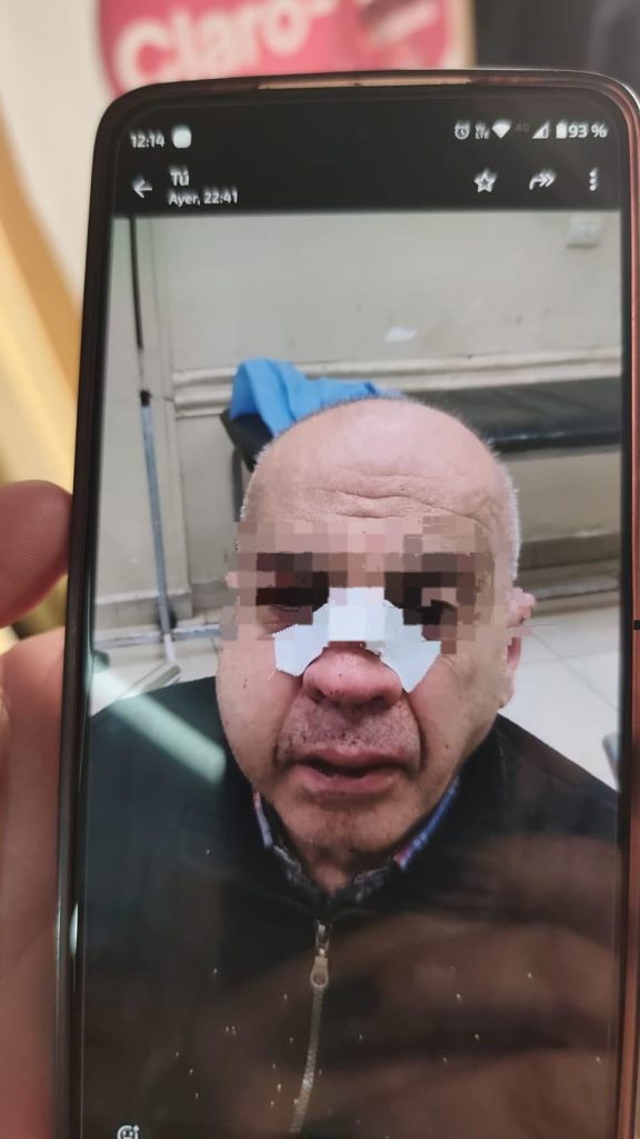 “Desfiguró a golpes a un vecino”: Desde un local de repuestos denuncian a un hombre por “violento”
