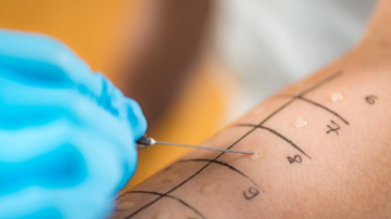 Día Mundial de la Alergia: una oportunidad para tomar conciencia, prevenir y actuar