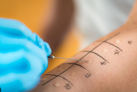 Día Mundial de la Alergia: una oportunidad para tomar conciencia, prevenir y actuar
