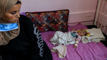 Alerta en Gaza por aumento de casos de meningitis infantil