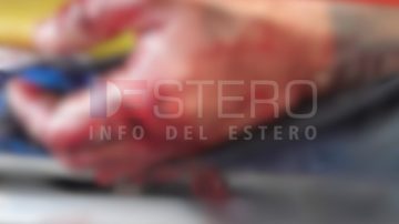 Un ciclista fue embestido por un auto en la ruta 34 vieja y sufrió gravísimas heridas