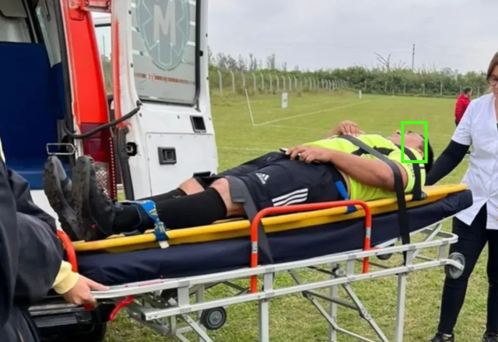 De nunca acabar: un árbitro de fútbol amateur fue agredido por un jugador
