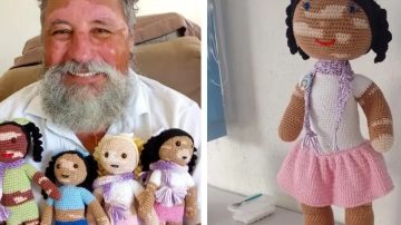 Un abuelo teje muñecos con vitiligo para promover la inclusión