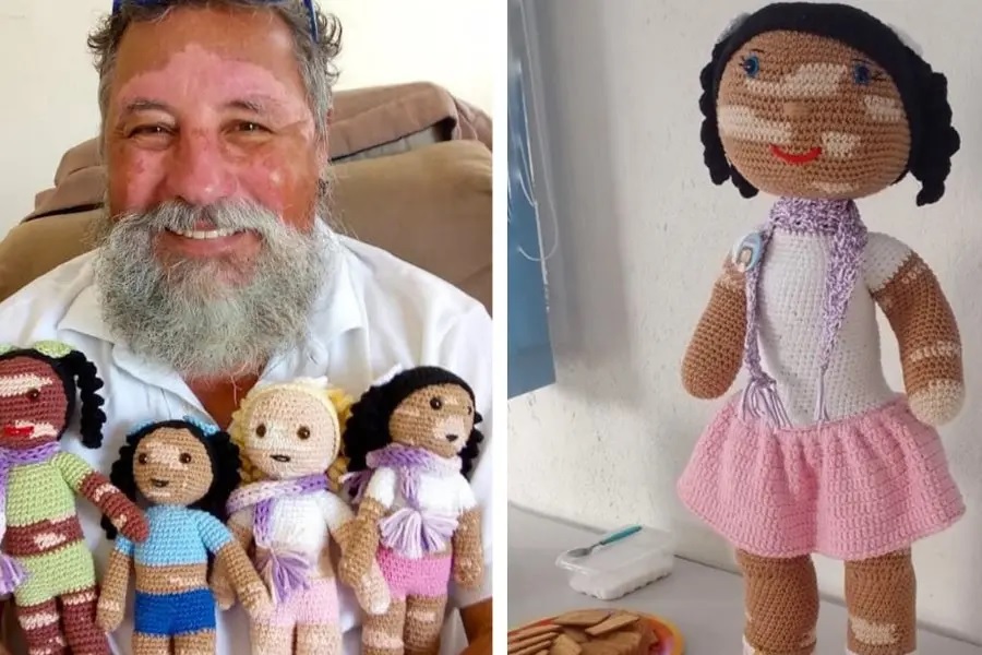 Un abuelo teje muñecos con vitiligo para promover la inclusión