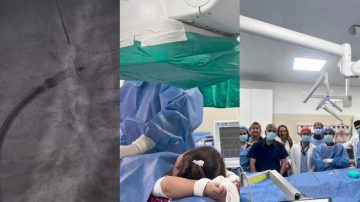Avance histórico en la salud pública en Santiago: realizaron con éxito una intervención cardíaca a una niña de 2 años
