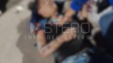 La Banda: Joven sufrió serias heridas tras “volar” de la moto en una calle en mal estado