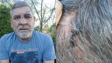 Aguirre contra las cuerdas: El Comisionado de El Zanjón evalúa renunciar luego del escándalo del fin se semana