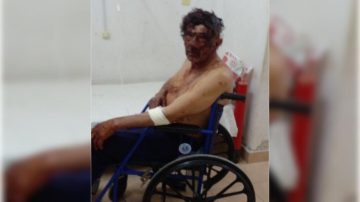 Conflicto de tierras: Alegan legítima defensa de un campesino que mató a uno de dos hombres que lo atacaba