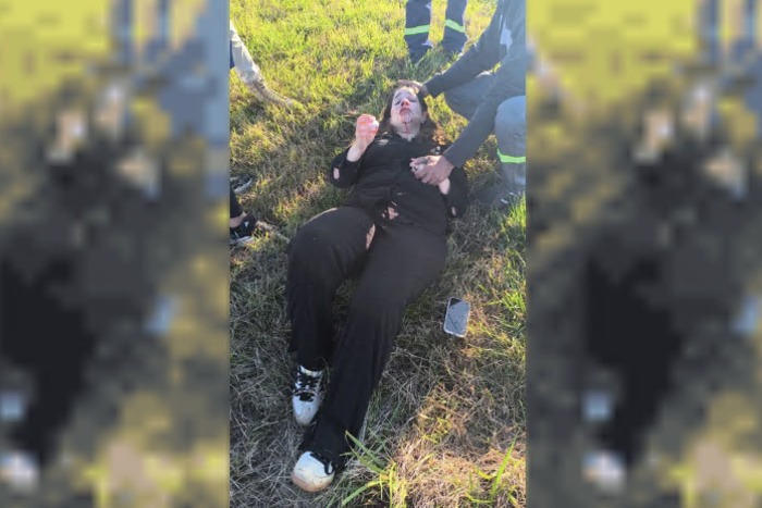 Una diputada de la LLA sufrió un accidente y dejó al descubierto las condiciones laborales de los choferes