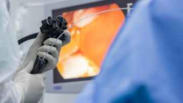 Alternativa para la obesidad: Realizan una reducción del estómago por la boca