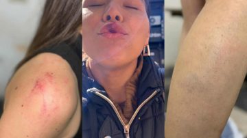 “Me cansé de guardar silencio solo para cuidarlo”: la valiente denuncia de una joven víctima de salvajes palizas a manos de su expareja