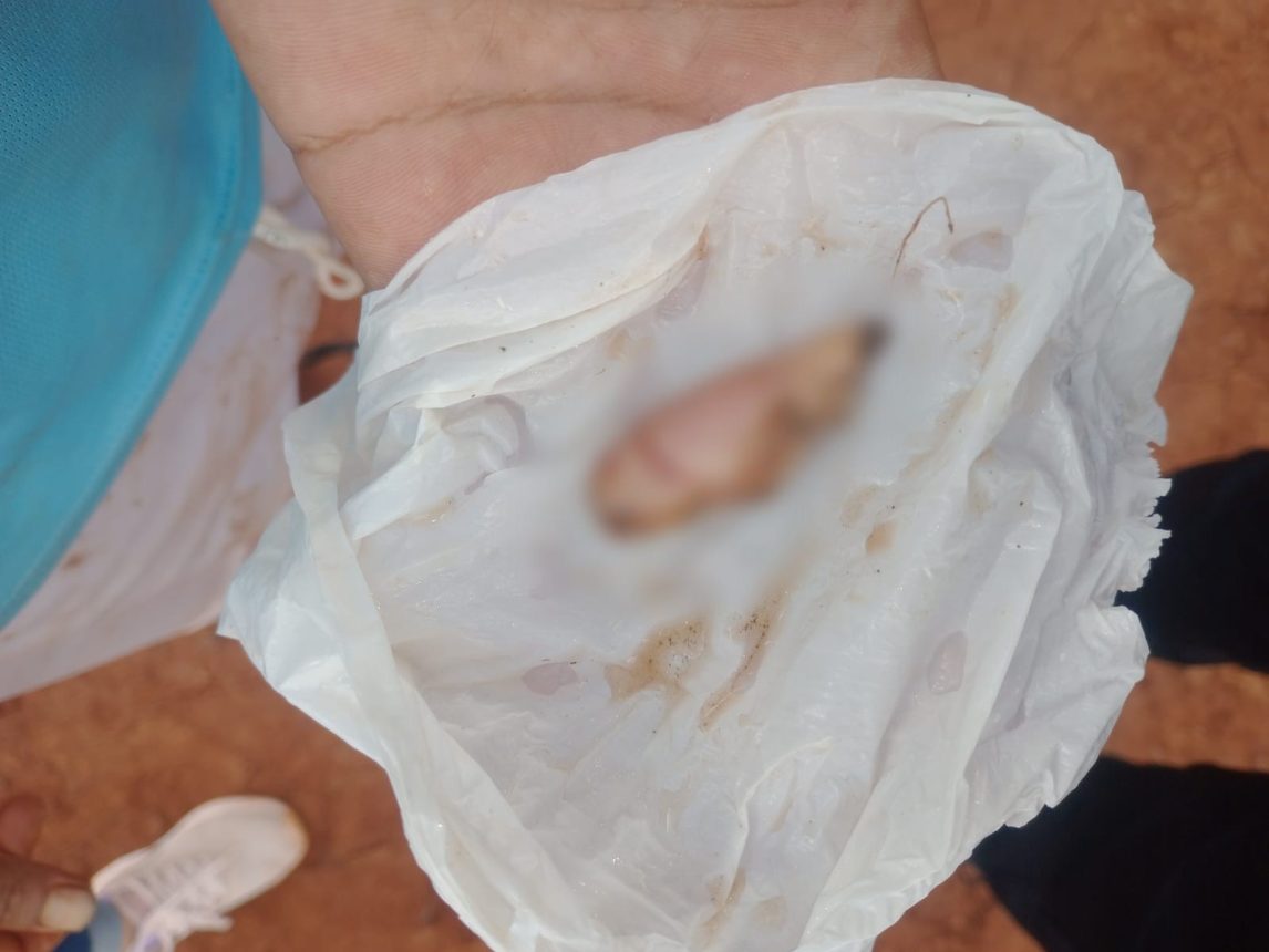 Adolescente atacó con un cuchillo a una mujer y le arrancó parte de la oreja