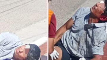 Un motochorro asaltó a una mujer de 71 años y en su fuga, chocó contra un poste: sufrió fracturas