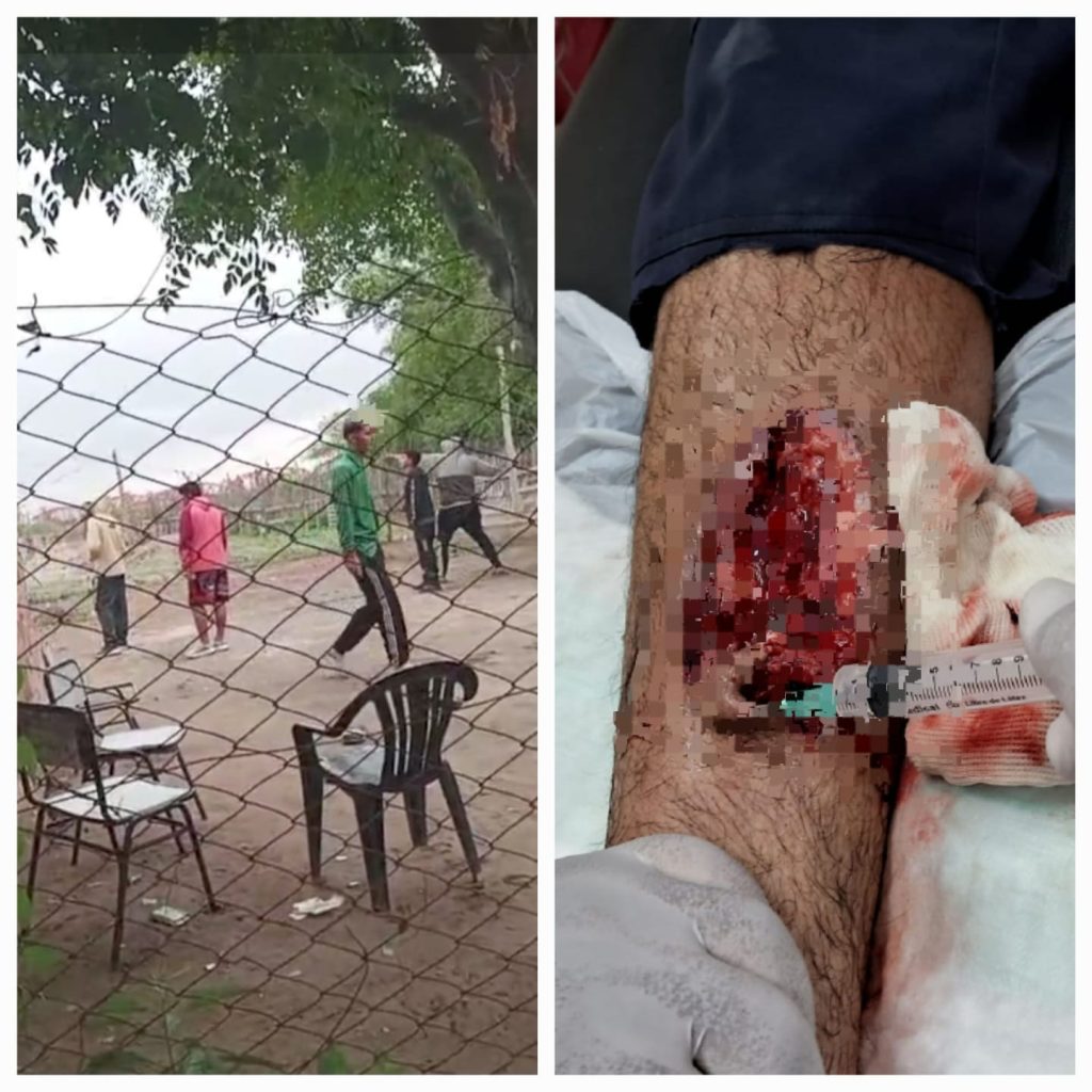 Operativo “Saturación”: 6 policías resultaron heridos en violento enfrentamiento en el B° Río Dulce