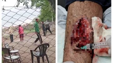 Operativo “Saturación”: 6 policías resultaron heridos en violento enfrentamiento en el B° Río Dulce