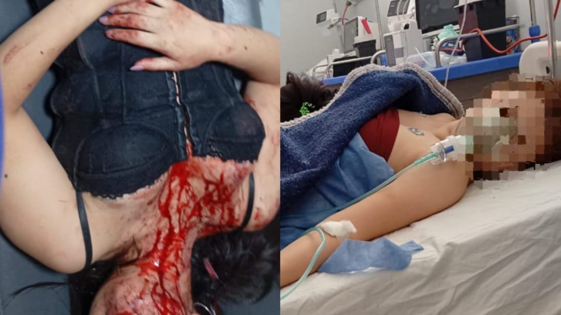 Brutal agresión de una menor a otra en un after: “Mi hija casi se desangra, le pegaron un botellazo en la cabeza”